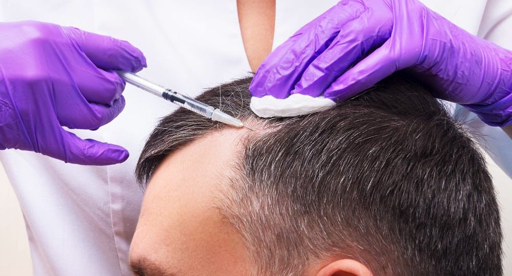 tendencias-tratamientos-capilares-en-clinicas-de-medicina-estetica