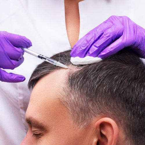 tendencias-tratamientos-capilares-en-clinicas-de-medicina-estetica